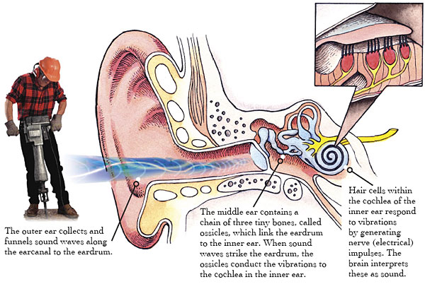 Hearing Loss in Factory Workers